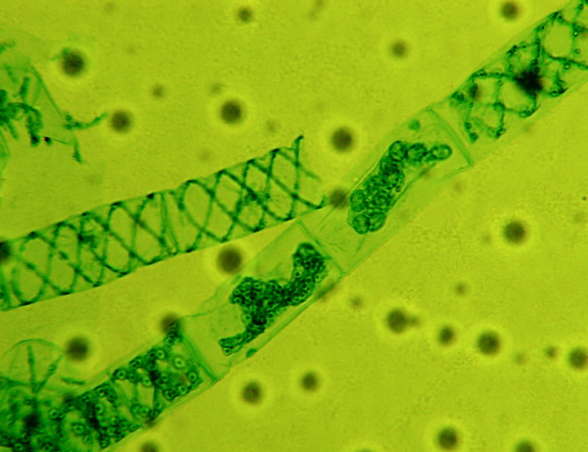 Green Alga Spirogyra